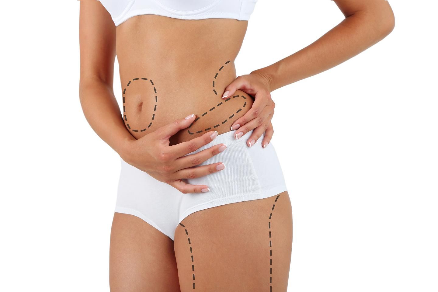 Liposuction Nedir ? Nasıl Yapılır ?