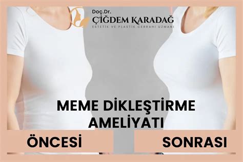 Göğüs Dikleştirme Ameliyatı: Estetik ve Fonksiyonel Avantajlar